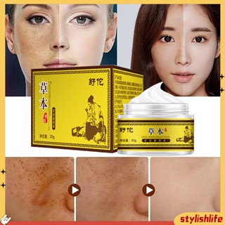 {stylishlife} 30g Dark Spot Freckle Removal Cream Facial Care Melasma Treatment