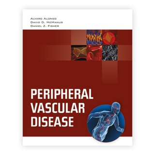 Peripheral Vascular Disease (Paperback) Year:2011 ISBN:9780763755386