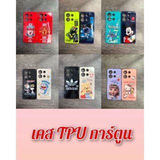 เคสTPUการ์ตูน📲OPPO A57.4g A83 A5s/A7/A12/F9 📲Wiko U10/U20 และรุ่นอื่นๆ มีสอนค้าพร้อมส่งจ้า