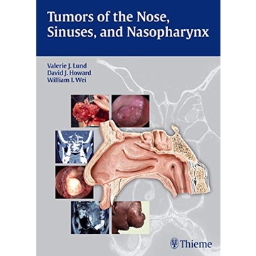 Tumors of The Nose, Sinuses and Nasopharynx (Hardcover) Yr:2014 ISBN:9783131471918