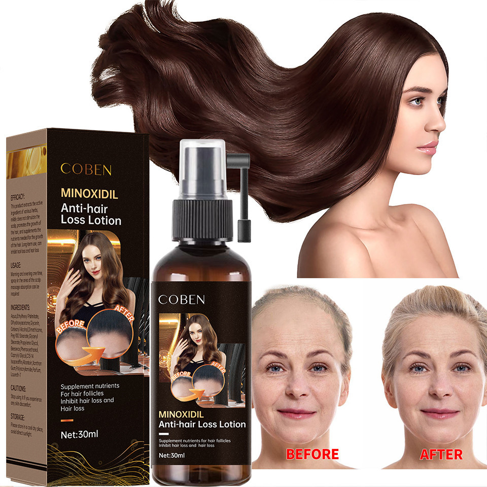IN STOCK!!IN STOCK!!!100% Natural Organic Hair Growth Treatment Serum Spray Keratin Anti Loss Repair Hair Growth Oil