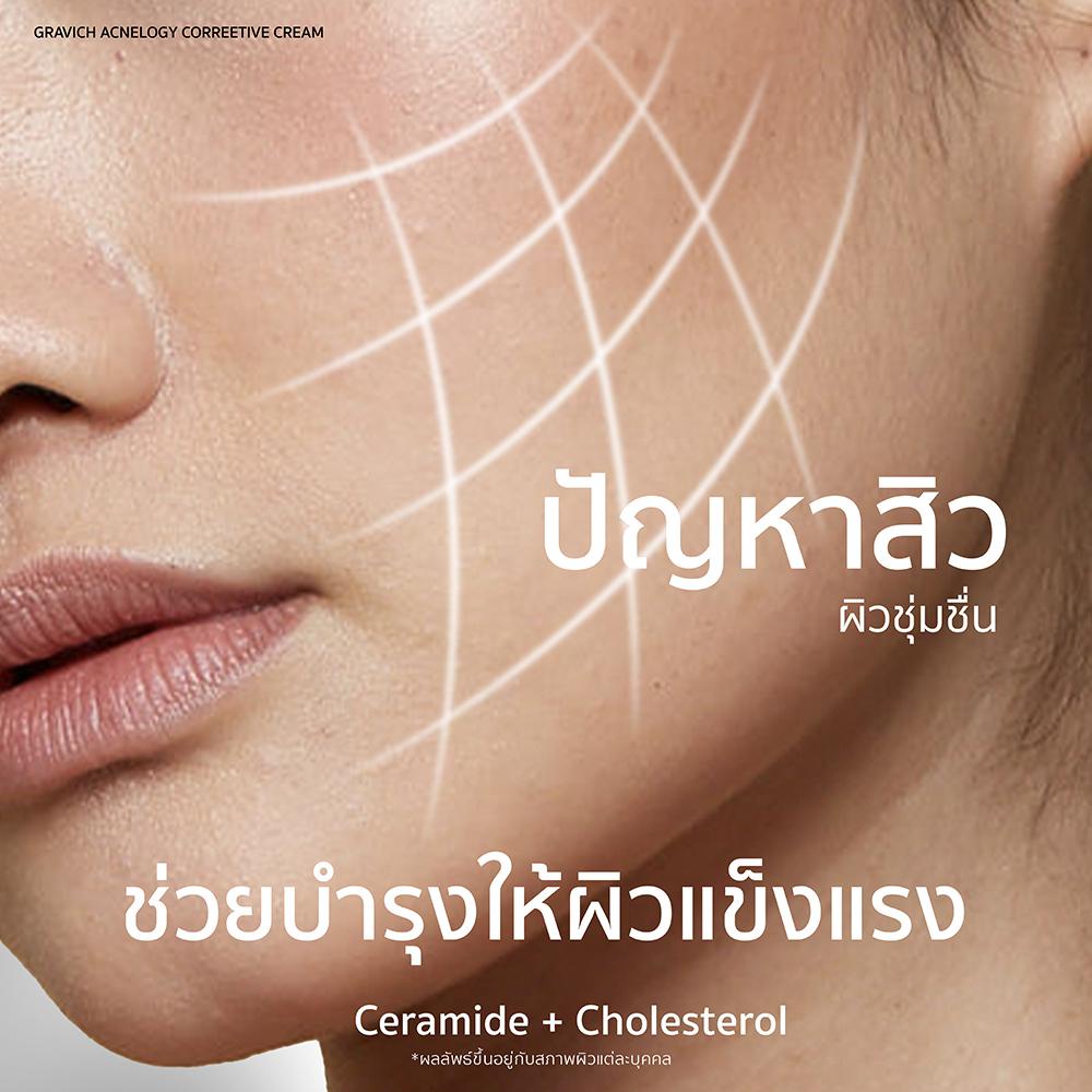 Gravich Acnelogy Corrective Cream 50 g มอยส์เจอร์ไรเซอร์ครีม สำหรับผิวเป็นสิว ลดสิวอุดตัน ราคา ถูกที่สุด ดีลบีเคเค แกลเลอรีภาพที่ 6