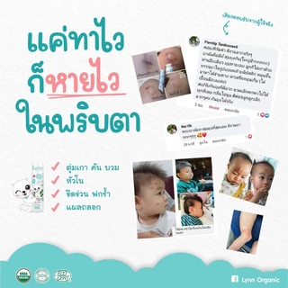 Lynn Organic บิ๊กบาล์ม (15 กรัม) แก๊งค์เบิ้ลๆ 2 แท่ง