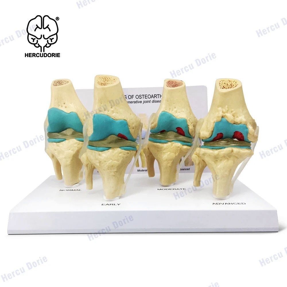 เข่าชุด | Human Body Anatomy Replica ชุด4 Anatomy EOFQ