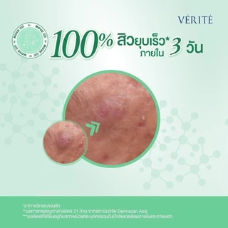 Verite Pre-Pro Acne Clearing Set [ชุดมูฟออนลูปสิว] ปิดจบต้นตอสิว เผยผิวใส