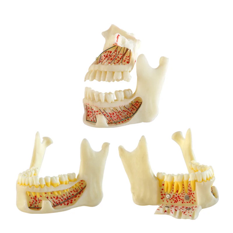 Anatomic Mandible Model Mandible with Hinge Buccal Dentist Student Learning Tool Dental Materials ZN