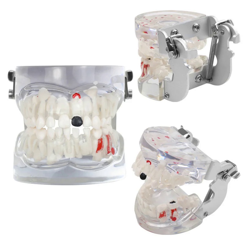 Transparent Milk Teeth Pathology Model Dental Teaching Model Dental Lab Instrument 88Z6