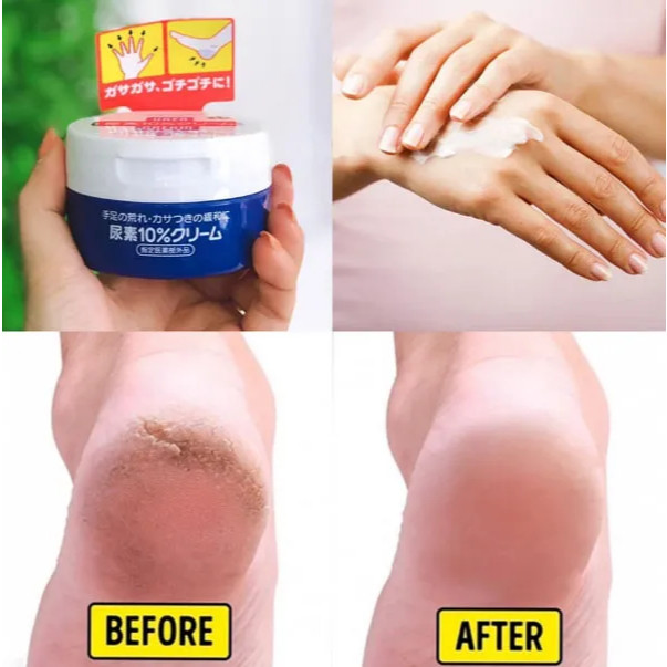 SHISEIDO Urea 10% Cream For Hand And Feet 60g /100g ครีมทามือ ทาเท้า body milk รูปที่ 3