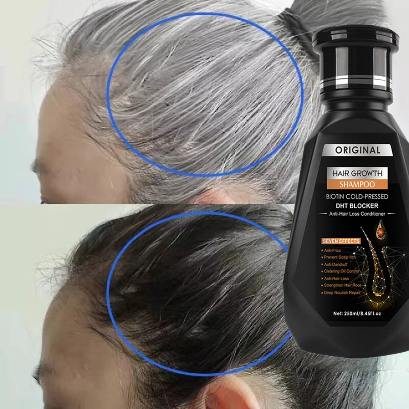 คลังสินค้าท้องถิ่น🏠PEIMEI แชมพูขิง แชมพูปลูกผม 250ml แชมพูผมหนา บำรุงลึก ฟื้นฟูเส้นผม สารสกัดจากธรรมชาติ บำรุงรากผม