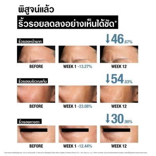นูโทรจีนา วิซิเบิล รีแพร์ เซรั่ม 30มล Neutrogena Visible Repair Serum 30ml, Retinol + Antioxidants + Comfort Complex