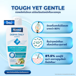[3ขวด] Nizoral Derma Daily ไนโซรัลเดอร์ม่า เดลลี่ แชมพูขจัดรังแค ขนาด 200 มล|ควบคุมความมัน ลดรังแค ฟื้นบำรุงหนังศีรษะ
