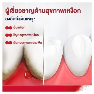 [เลือกสูตรได้] PARODONTAX TOOTHPASTE พาโรดอนแทกซ์ ยาสีฟัน สูตรฟลูออไรด์ ปกป้องสุขภาพเหงือก ป้องกันฟันผุ 150 กรัม แพ็ค 2