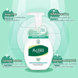 Mentholatum Acnes Pimple & Oil Controlling Foamy Wash 150g เมนโทลาทั่ม แอคเน่ส์ โฟมนุ่มลดสิวคุมมัน 150ก. 1 หน่วย
