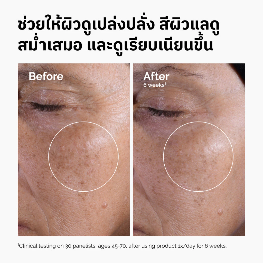 The Ordinary Glycolic Acid 7% Exfoliating Toner - 240mL | โทนเนอร์ผลัดเซลล์ผิว ผิวเรียบเนียน สีผิวแลดูสม่ำเสมอ thumbnail 3