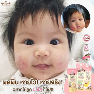 Carelybe ครีมลดและป้องกันผดผื่น ผดร้อน เกลื้อนน้ำนม ภูมิแพ้ผิวหนัง ผื่นผ้าอ้อม จากแป้งข้าวธรรมชาติ ใช้ได้ตั้งแต่แรกเกิด
