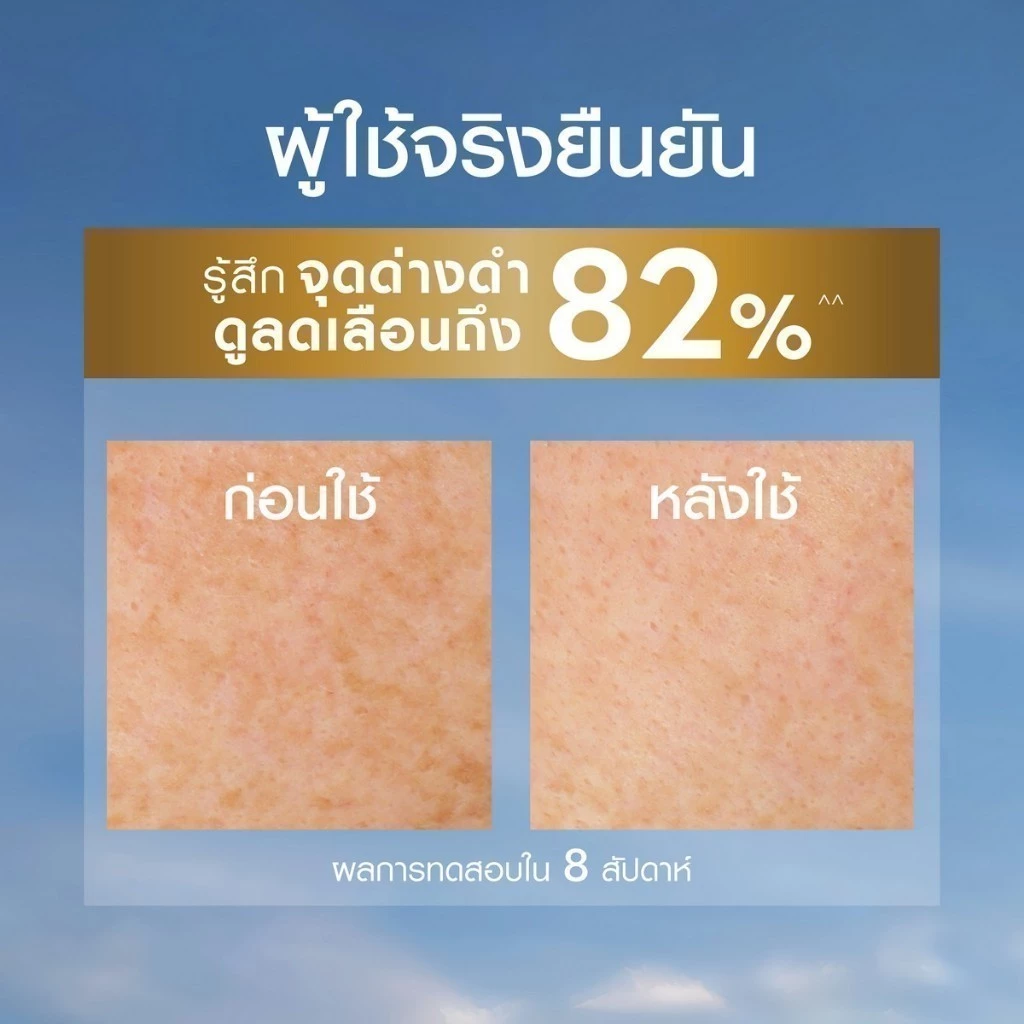 [สินค้าขายดี]นีเวีย ลูมินัส630 แอนตี้สปอต แอดวานซ์ สปอต เซรั่ม เซรั่มทาฝ้า เซรั่มลดจุดด่างดำ 30 มล. NIVEA เซรั่ม thumbnail 6