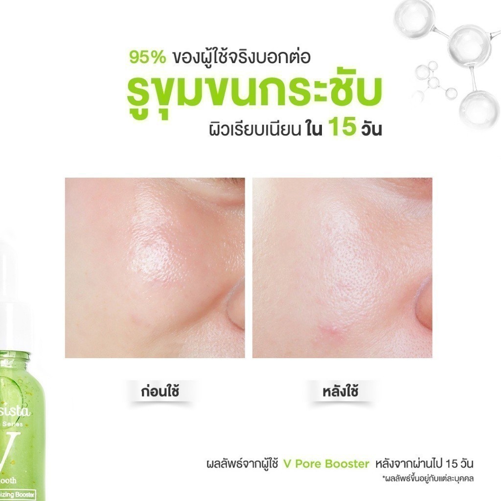 [เซตสุดคุ้ม] - Skinsista V Pore บูสเตอร์เซรั่มกระชับรูขุมขน ผิวเรียบเนียน คุมมัน (15ml x2) - รูปที่ 4