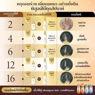 50 Megumi Anti-Hair Loss Treatment Essence 160ml ฟิฟตี้ เมกุมิ เอสเซ้นซ์เพิ่มต่อมรากผม 160ก. 1 หน่วย
