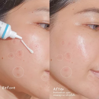ZERMIX Forte Cream 65ml. มอยส์เจอไรเซอร์ บำรุงผิวหน้าสำหรับผิวแพ้ง่าย เซอร์มิกซ์ (ครีมผิวแพ้ง่าย)