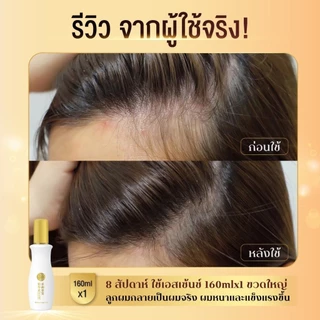 50 Megumi Anti-Hair Loss Treatment Essence 160ml ฟิฟตี้ เมกุมิ เอสเซ้นซ์เพิ่มต่อมรากผม 160ก. 1 หน่วย