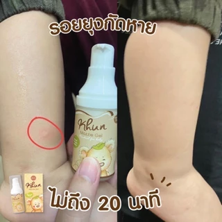 เจลลดคัน ลดรอยดำ จากยุงมดแมลงกัด สำหรับเด็ก Khun Organic ตุ่มยุบภายใน20นาที ออแกนิค100% ใช้ได้ตั้งแต่แรกเกิด