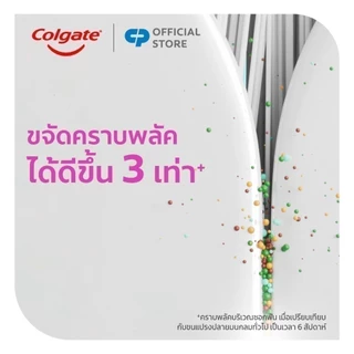 แปรงสีฟัน คอลเกต สลิมซอฟท์ ออร์โธ (สำหรับคนจัดฟัน) (คละสี) Colgate Slim Soft Ortho Toothbrush (mixed color)