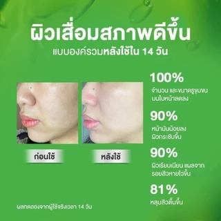 Skinsista บูสเตอร์ เซรั่ม ผิวเรียบเนียน ละเอียด คุมมัน Poreless Smooth Pore Minimizing Booster 20ml.