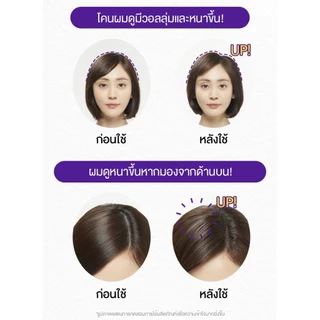 [แพ็คคู่] RYO HAIR LOSS EXPERT CARE SHAMPOO FOR OILY SCALP l เรียว แฮร์ ลอส เอ็กซ์เปิร์ท แคร์ แชมพู ฟอร์ ออยลี่ สแคลพ