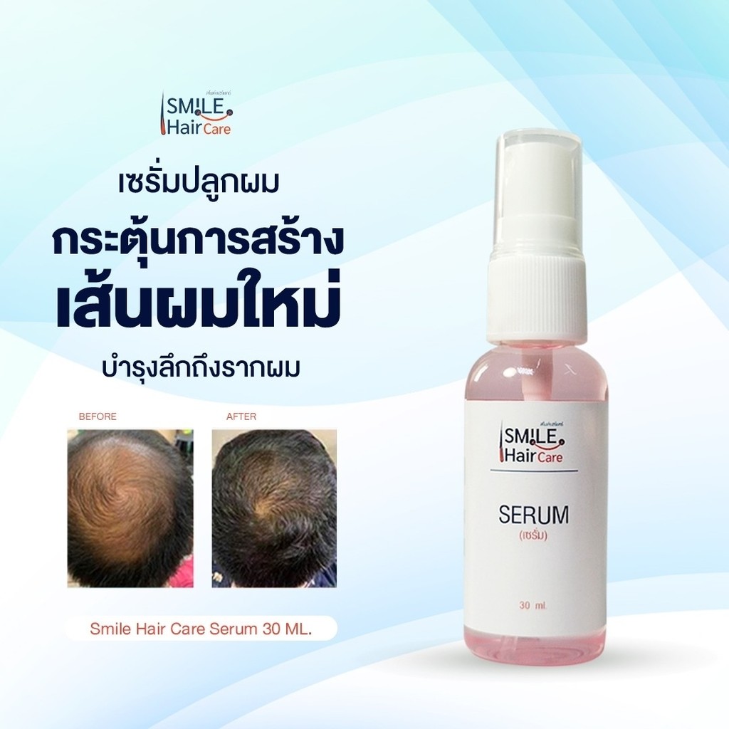 [เซรั่มใหญ่ 1 ขวด] เซรั่มบำรุงเส้นผมแบบสเปร์ยฉีด แก้ผมร่วง ผมบาง ผมแห้งเสีย สูตรแพทย์แนะนำจากโรงพยาบาล