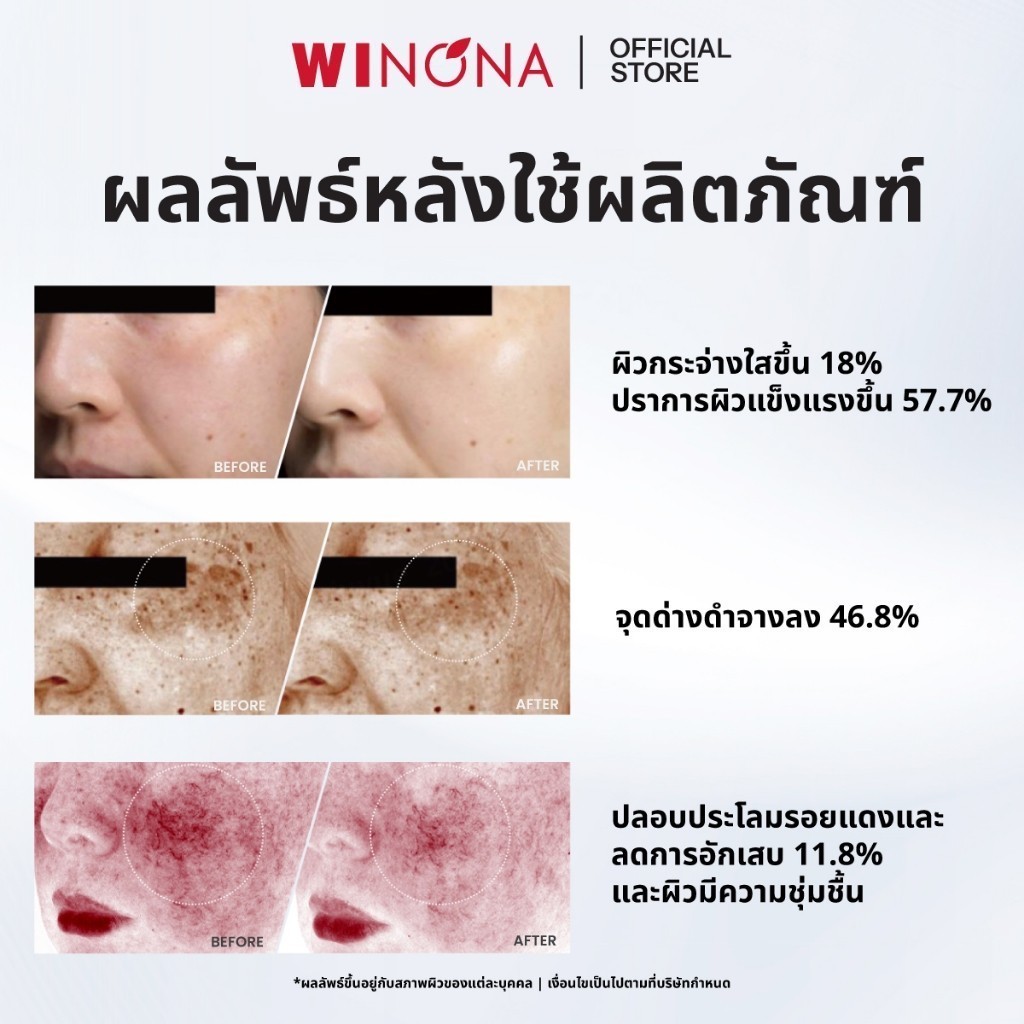 Winona Brightening & Spot - Fading วิโนน่า เอสเซนส์ลดเลือนจุดด่างดำ บูสผิวใส (1.5ml x 30 ขวด) — صورة 7