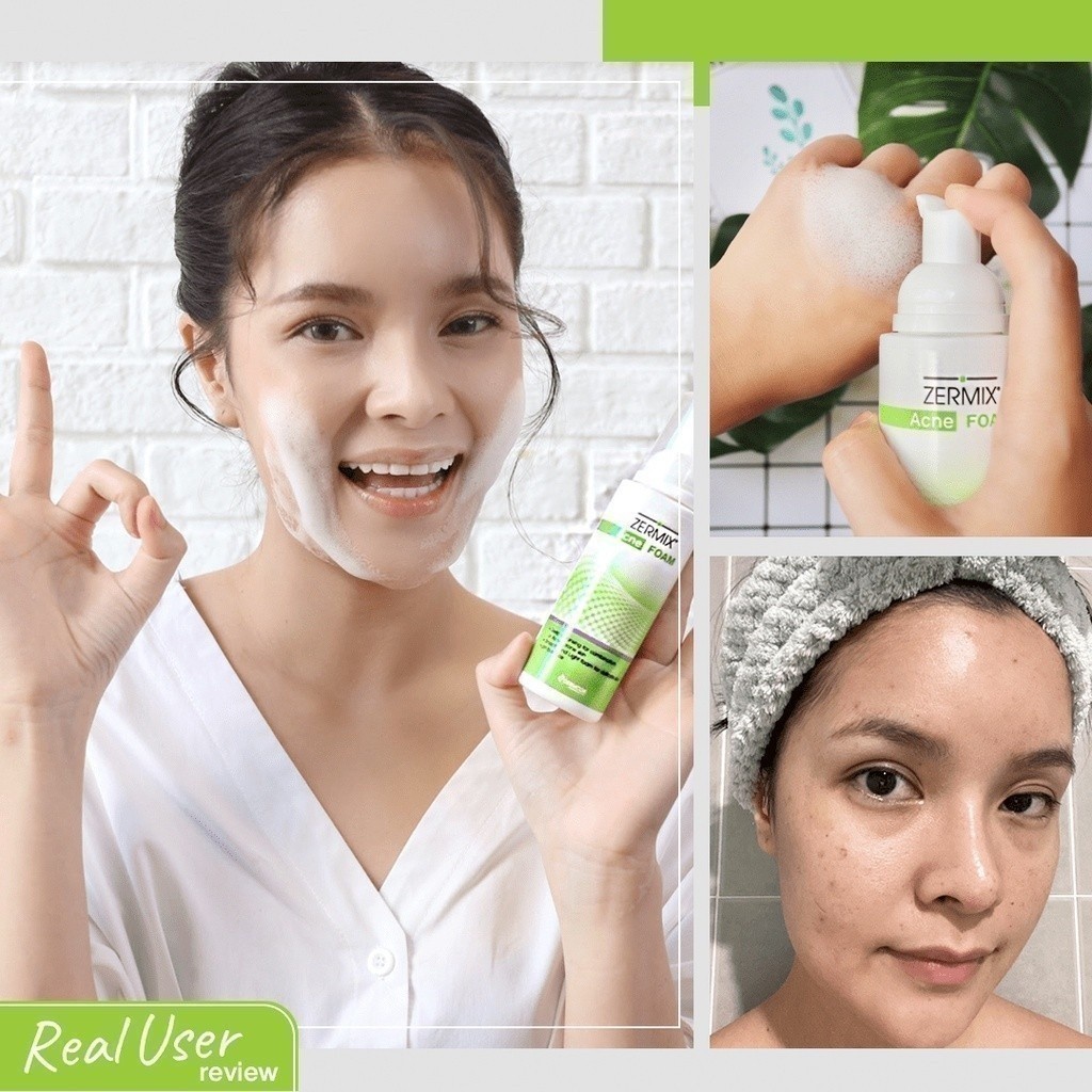 [แพ็กสุดคุ้ม] ZERMIX Acne Foam 100ml. 3ขวด โฟมล้างหน้าลดสิว สำหรับผิวแพ้ง่าย เซอร์มิกซ์ (ล้างหน้าลดสิว ลดหน้ามัน) — صورة 7