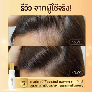 [ซื้อ1 แถม 1] 50 Megumi Anti-Hair Loss Treatment Essence 160ml เอสเซ้นซ์เพิ่มต่อมรากผม