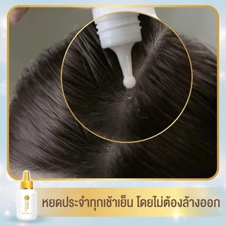 [ซื้อ1 แถม 1] 50 Megumi Anti-Hair Loss Treatment Essence 160ml เอสเซ้นซ์เพิ่มต่อมรากผม