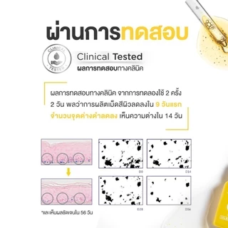 Skinsista Vit C บูสเตอร์เซรั่ม วิตซี ลดรอยสิว เพื่อผิวสว่าง กระจ่างใส 15ml