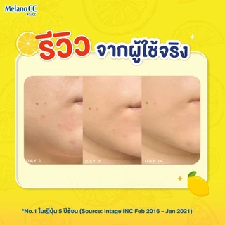 Melano CC Vitamin C Brightening Essence 20ml เมลาโน ซีซี ไบรท์เทนนิ่ง เอสเซ้นส์ 20มล. วิตามินซีเข้มข้น 1 หน่วย