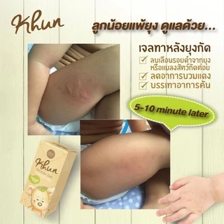 เจลลดคัน ลดรอยดำ จากยุงมดแมลงกัด สำหรับเด็ก Khun Organic ตุ่มยุบภายใน20นาที ออแกนิค100% ใช้ได้ตั้งแต่แรกเกิด