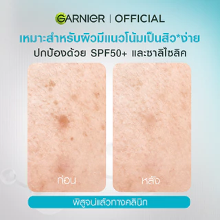 [ลดจุกๆ!ลดเหลือ259.-ในไลฟ์] การ์นิเย่ ซุปเปอร์ ยูวี แอนตี้-แอคเน่ เซรั่ม ซันสกรีน 30มล. GARNIER SUPER UV ANTI-ACNE SERUM