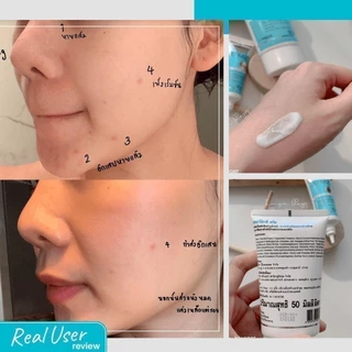 [ชุดของแถม 2ชิ้น] Zermix cream 15 ml 2 ชิ้น ครีมบำรุงผิวหน้ามอยส์เจอร์ไรเซอร์ สำหรับผิวแห้ง