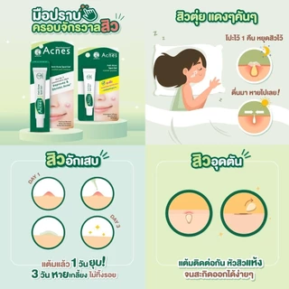 Mentholatum Acnes Anti-Acne Spot Gel 18g เมนโทลาทั่ม แอคเน่ส์ แอนไท-แอคเน่ สปอต เจล 18ก. เจลแต้มสิวฉุกเฉิน 1 หน่วย