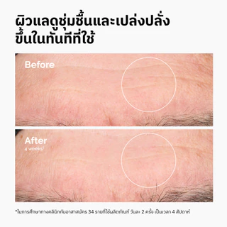 The Ordinary Hyaluronic Acid 2% + B5 | เซรั่มเพื่อผิวชุ่มชื้น อิ่มเอิบ เปล่งปลั่ง เรียบเนียน