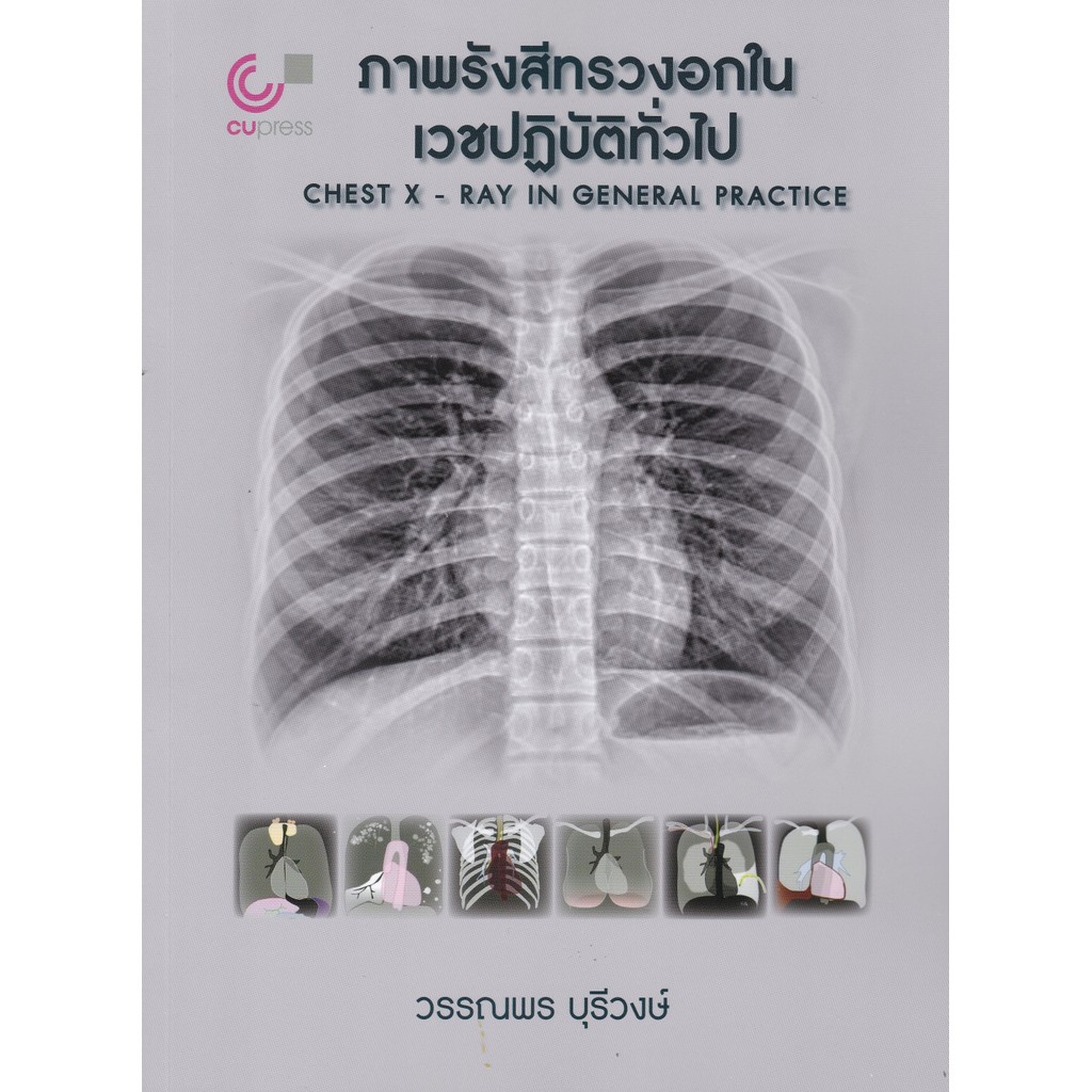 Chulabook|c112|หนังสือ|ภาพรังสีทรวงอกในเวชปฏิบัติทั่วไป 9789740343653