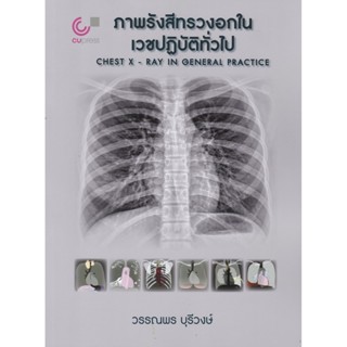 [Chulabook] หนังสือ ภาพรังสีทรวงอกในเวชปฏิบัติทั่วไป (CHEST …