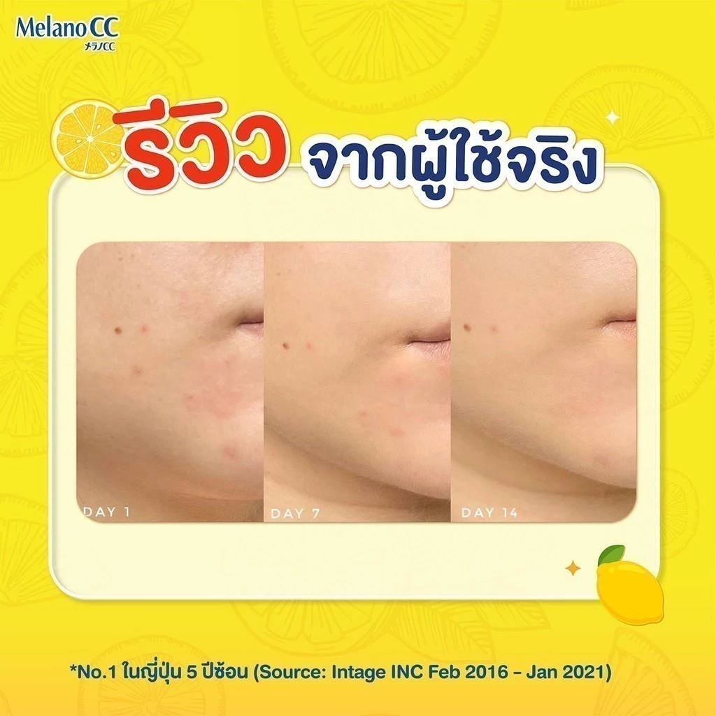 [1แถม1] Melano CC Vitamin C Brightening Essence 20ml. เมลาโน ซีซี วิตามินซี ไบรท์เทนนิ่ง เอสเซ้นส์ 20มล thumbnail 4