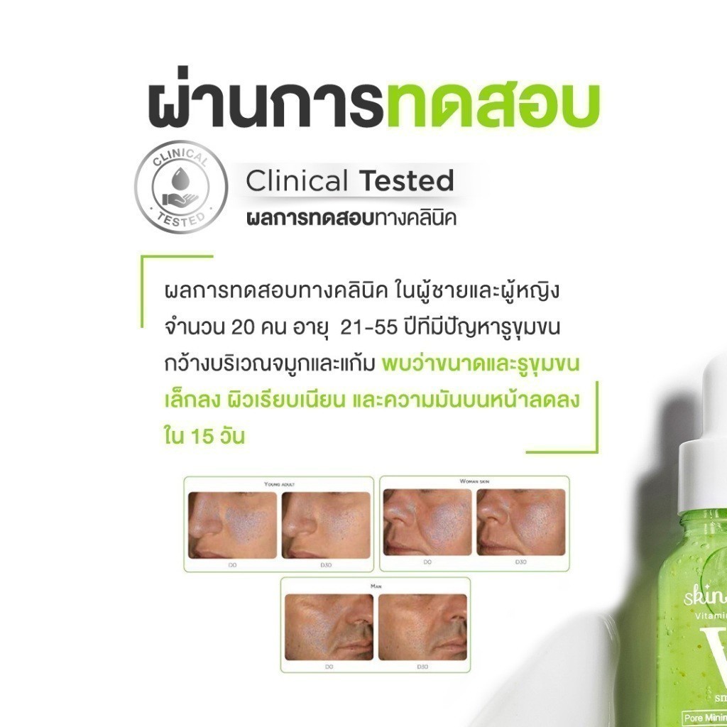 [เซตสุดคุ้ม] - Skinsista V Pore บูสเตอร์เซรั่มกระชับรูขุมขน ผิวเรียบเนียน คุมมัน (15ml x2) - รูปที่ 3