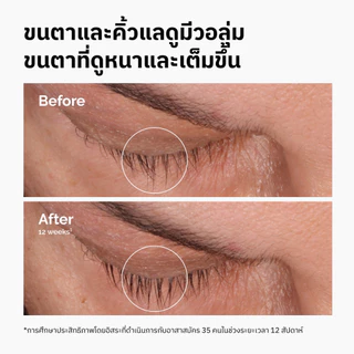 The Ordinary Multi-Peptide Lash & Brow Serum - 5mL |เซรั่มบำรุงขนตาและคิ้ว เพิ่มความหนาและเต็มขึ้น เส้นขนสุขภาพดี
