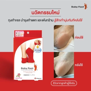 Baby Foot Moisturizing Gel Heel Socks I ถุงเท้าบำรุงส้นเท้าแตกและแห้งกร้าน