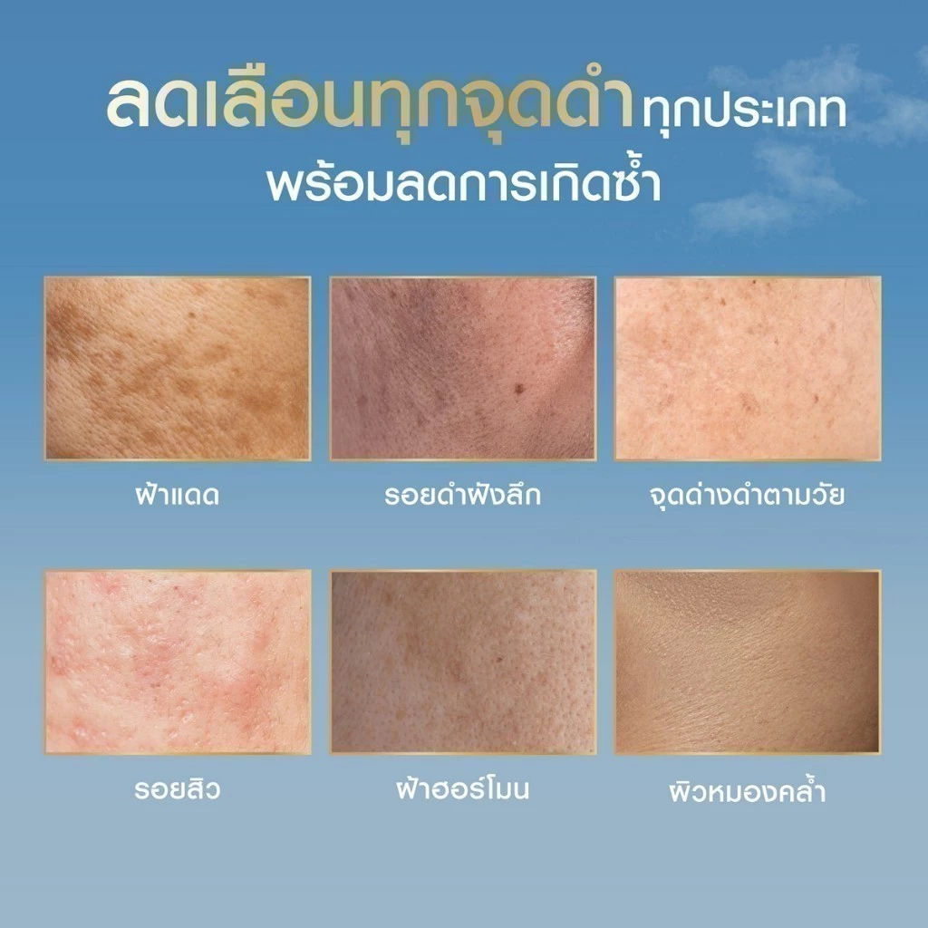 [สินค้าขายดี]นีเวีย ลูมินัส630 แอนตี้สปอต แอดวานซ์ สปอต เซรั่ม เซรั่มทาฝ้า เซรั่มลดจุดด่างดำ 30 มล. NIVEA เซรั่ม thumbnail 7
