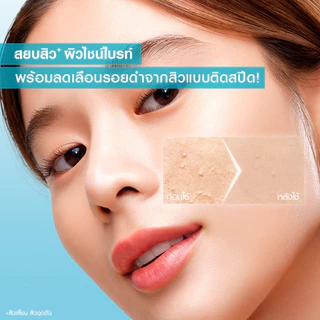 [ลดจุกๆ!ลดเหลือ299.-ในไลฟ์] การ์นิเย่ สกิน แนทเชอรัลส์ ไบรท์ คอมพลีท แอนตี้-แอคเน่ บูสเตอร์ เซรั่ม 30มล. GARNIER ANTI-AC