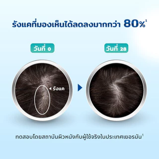 [3ขวด] Nizoral Derma Daily ไนโซรัลเดอร์ม่า เดลลี่ แชมพูขจัดรังแค ขนาด 200 มล|ควบคุมความมัน ลดรังแค ฟื้นบำรุงหนังศีรษะ