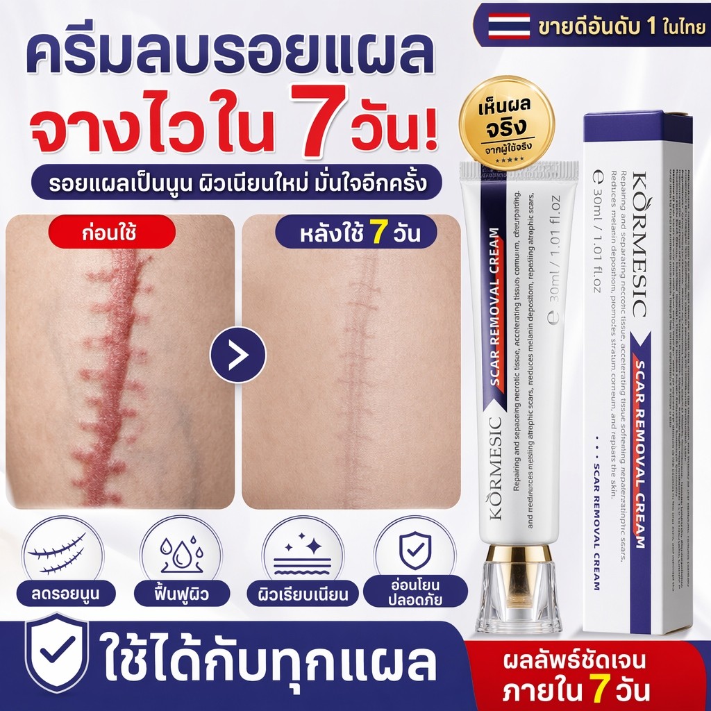 Scar Cream ครีมลบรอยแผลเป็น 30ก ลบรอยสีดำ แผลไฟไหม้ รอยแตกลาย ช่วยรอยจางหายมีประสิทธิภาพ